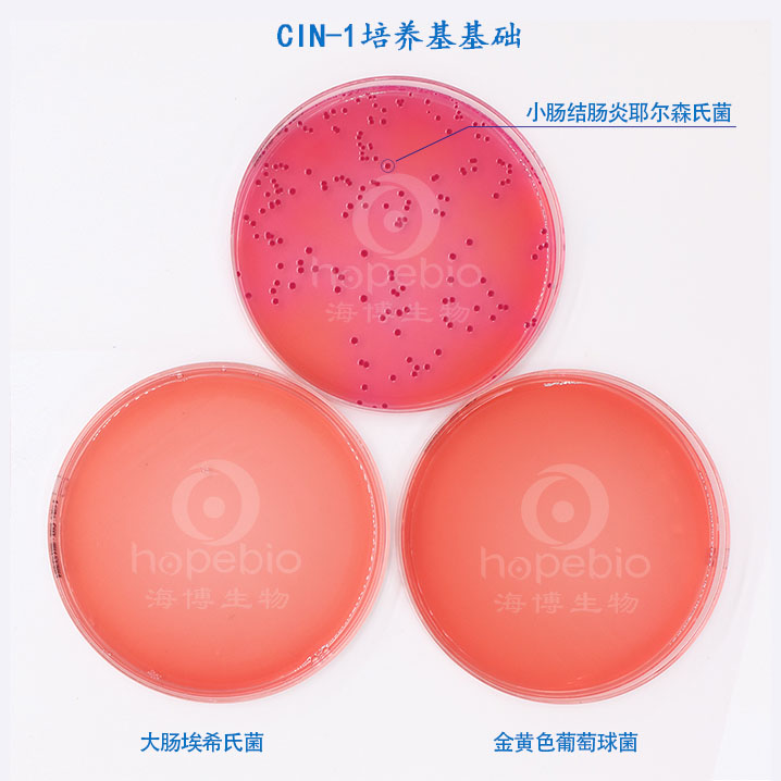 CIN-1